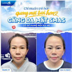 CHỈ MUỐN TRẺ HƠN – GƯƠNG MẶT TƯƠI HƠN