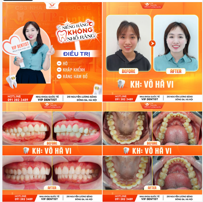 RẠNG RỠ ĐÓN NỤ CƯỜI MỚI CÙNG HÀ VI!