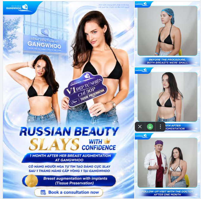 CÔ NÀNG NGƯỜI NGA TỰ TIN TẠO DÁNG CỰC SLAY - SAU 1 THÁNG NÂNG CẤP VÒNG 1 TẠI GANGWHOO
