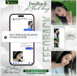 FEEDBACK CHIA SẺ CỦA KHÁCH HÀNG NÂNG MŨI CẤU TRÚC TẠI TUẤN LINH!!!