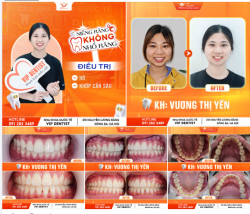 MIỆNG CƯỜI XINH XẮN - KHUÔN MẶT HÀI HÒA