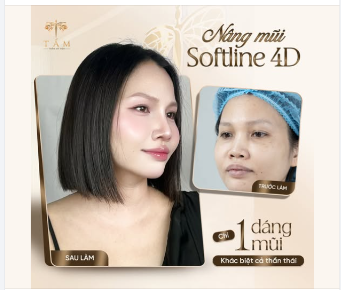 Góc nghiêng thần thánh không tự nhiên sinh ra, nhưng hoàn toàn có thể tạo nên