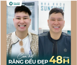 Lột xác nụ cười chỉ sau 2 ngày tại Sunshine!