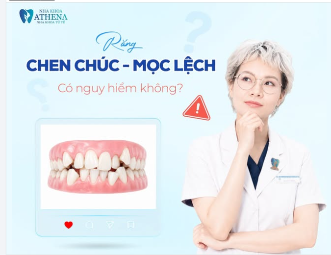 RĂNG CHEN CHÚC, MỌC LỆCH CÓ NGUY HIỂM KHÔNG?