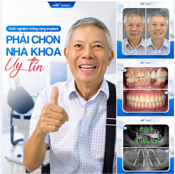 “MỘT LẦN CHỌN SAI, TÔI MỚI HIỂU TÌM ĐÚNG NHA KHOA UY TÍN QUAN TRỌNG ĐẾN THẾ NÀO”