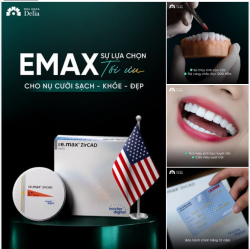 Emax dòng sứ cao cấp mang đến vẻ đẹp nguyên bản