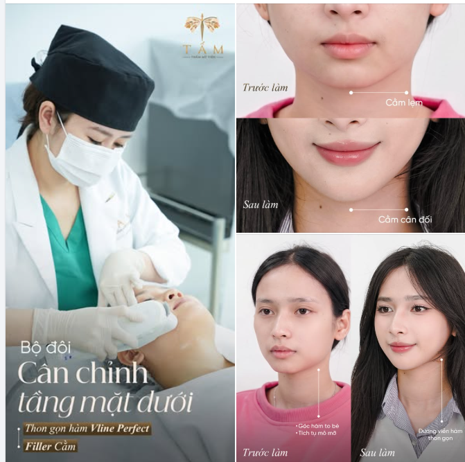 BỘ ĐÔI CÂN CHỈNH ĐƯỜNG NÉT TẦNG MẶT DƯỚI
