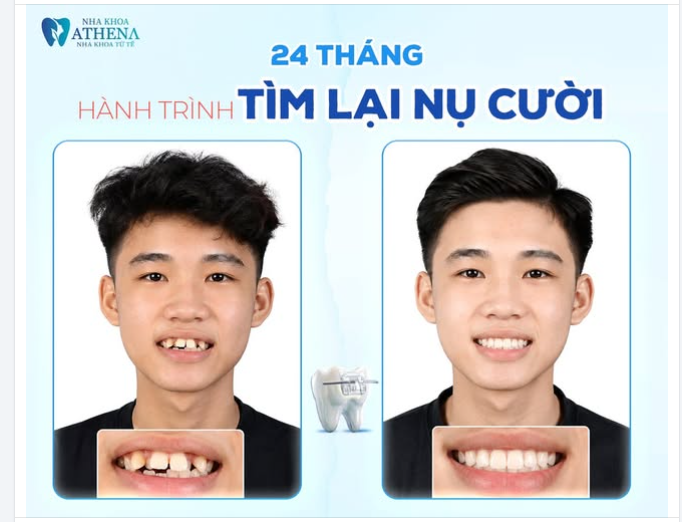 24 THÁNG - HÀNH TRÌNH TÌM LẠI NỤ CƯỜI