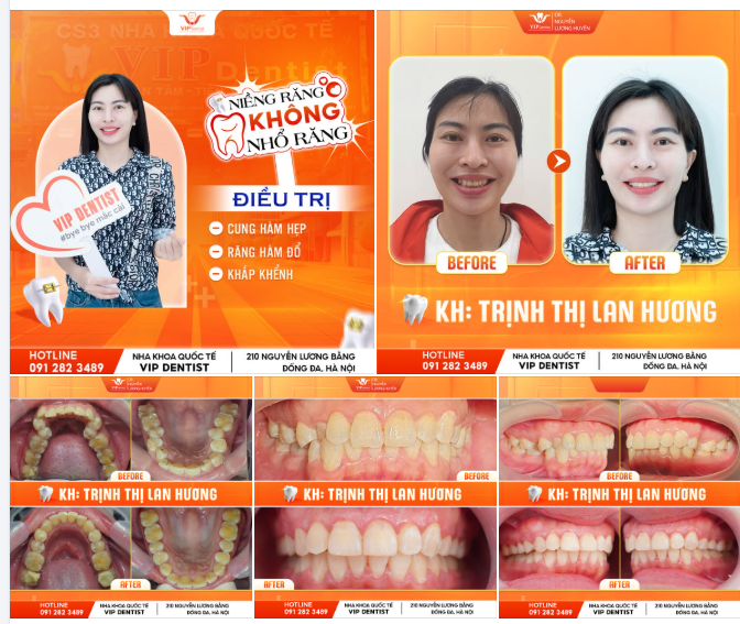 RẤT BẤT NGỜ VÌ CHỈ SAU 1,5 NĂM LÀ ĐÃ XONG!
