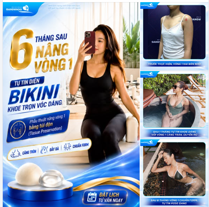 6 THÁNG SAU NÂNG VÒNG 1- TỰ TIN DIỆN BIKINI KHOE TRỌN VÓC DÁNG