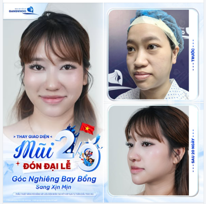 THAY GIAO DIỆN MŨI - ĐÓN ĐẠI LỄ 2/9