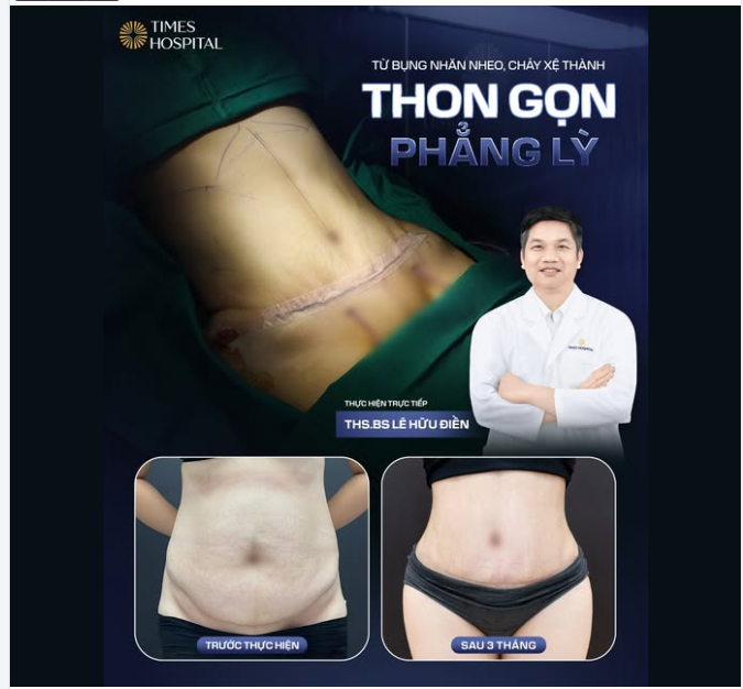 TỪ BỤNG NHĂN NHEO, CHẢY XỆ ĐẾN VÒNG 2 THON GỌN