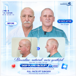 NAM TÍNH, TỰ NHIÊN, TRẺ HƠN - MR.B - 66 TUỔI - ÚC