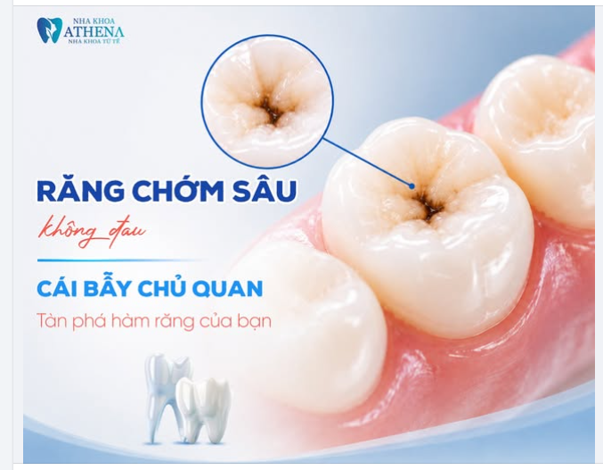 RĂNG CHỚM SÂU KHÔNG ĐAU: CÁI BẪY CHỦ QUAN TÀN PHÁ HÀM RĂNG CỦA BẠN!