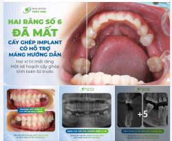 HAI KHOẢNG TRỐNG SỐ 6 VÀ HÀNH TRÌNH LẤP ĐẦY BẰNG MỘT KẾ HOẠCH ĐƯỢC TÍNH TOÁN KỸ LƯỠNG