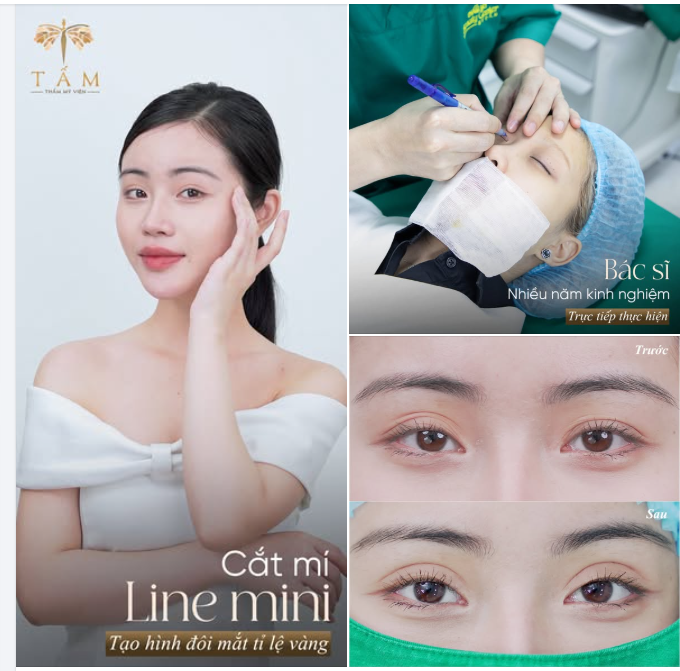 CẮT MÍ LINE MINI - MÍ SẮC NÉT, ĐẸP TỰ NHIÊN