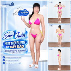 MÊ MẨN VÓC SÁNG SAU HÚT MỠ BỤNG VÀ CẤY ĐÀO