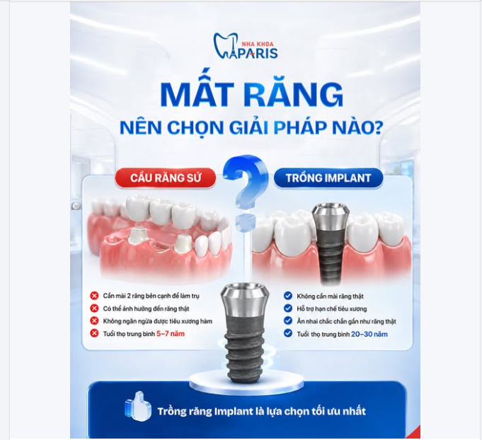 MẤT RĂNG NÊN CHỌN GIẢI PHÁP NÀO: CẦU RĂNG SỨ HAY TRỒNG IMPLANT?