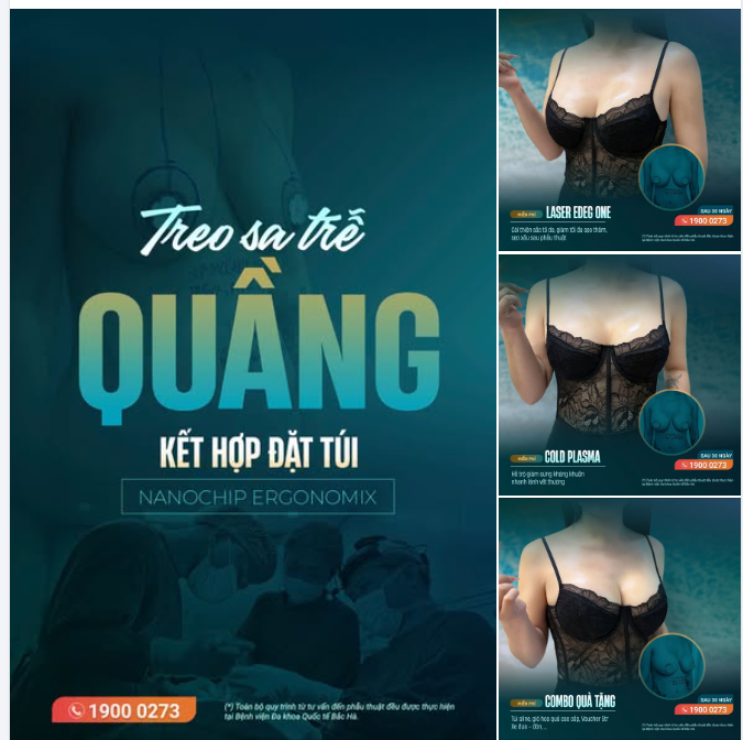 TREO SA TRỄ ĐƯỜNG QUẦNG – KHI VÒNG 1 CẦN NHIỀU HƠN MỘT BƯỚC ĐẶT TÚI