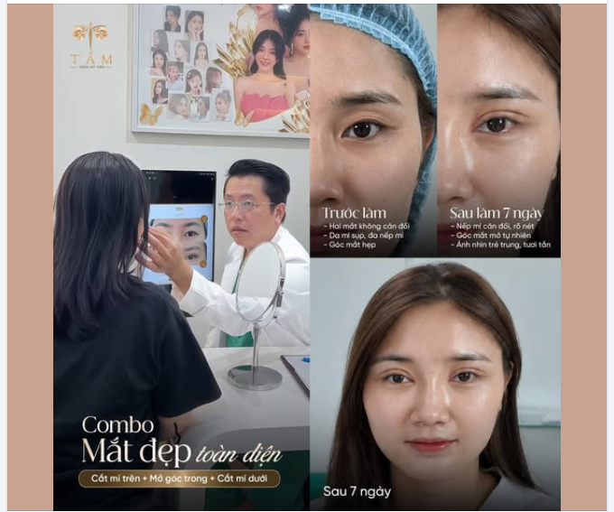 Sau khi tham khảo nhiều nơi, "nằm vùng" nhiều tháng, bạn N.Q quyết định gửi gắm đôi mắt tại Tấm.