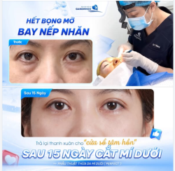 TRẢ LẠI THANH XUÂN CHO "CỬA SỔ TÂM HỒN"