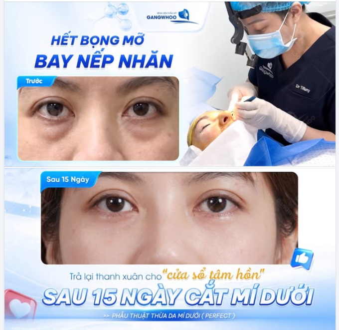 TRẢ LẠI THANH XUÂN CHO "CỬA SỔ TÂM HỒN"