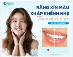 CÓ BAO GIỜ BẠN LỠ TAY XÓA MỘT TẤM ẢNH CHỈ VÌ NỤ CƯỜI CHƯA TỰ TIN?