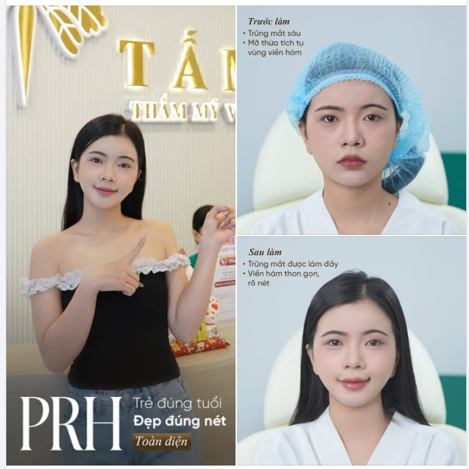 PRH - Xu hướng trẻ hoá thế hệ mới