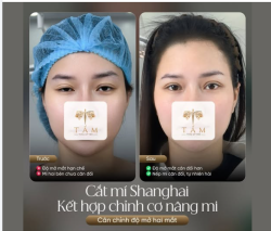 LẤY LẠI SỰ TỰ TIN VỚI ÁNH NHÌN RẠNG RỠ!