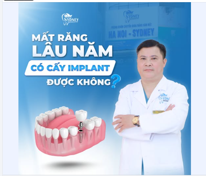 MẤT RĂNG LÂU NĂM CÓ CẤY IMPLANT ĐƯỢC KHÔNG?