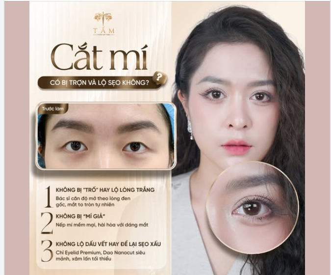 Nhìn ảnh Before After mới thấy đôi mắt to tròn thay đổi cả thần thái gương mặt thế nào!
