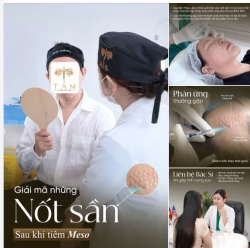 BÍ MẬT ĐẰNG SAU NHỮNG NỐT SẦN KHI TIÊM MESO