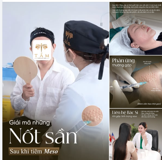 BÍ MẬT ĐẰNG SAU NHỮNG NỐT SẦN KHI TIÊM MESO