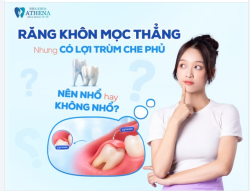 RĂNG KHÔN MỌC THẲNG NHƯNG BỊ LỢI TRÙM: NÊN NHỔ HAY GIỮ?