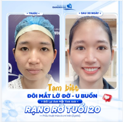 TẠM BIỆT ĐÔI MẮT MÍ LÓT
