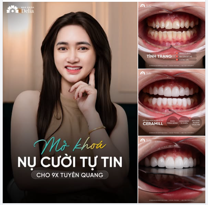 MỞ KHÓA NỤ CƯỜI TỰ TIN — HÀNH TRÌNH ĐỒNG HÀNH CÙNG 9X TUYÊN QUANG!