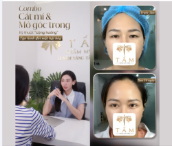 COMBO CẮT MÍ MỞ GÓC TRONG – KỸ THUẬT "CỘNG HƯỞNG" TẠO HÌNH ĐÔI MẮT HÀI HÒA 