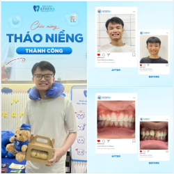 TỪ TỰ TI ĐẾN NỤ CƯỜI TỎA SÁNG
