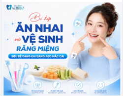 BÍ KÍP ĂN NHAI VÀ VỆ SINH RĂNG MIỆNG: SIÊU DỄ DÀNG KHI ĐANG ĐEO MẮC CÀI!