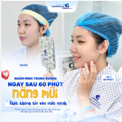 THẬT KHÔNG TIN VÀO MẮT MÌNH