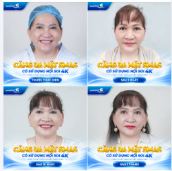 HÀNH TRÌNH TỪ NGÀY ĐẦU ĐẾN DIỆN MẠO TRẺ HƠN
