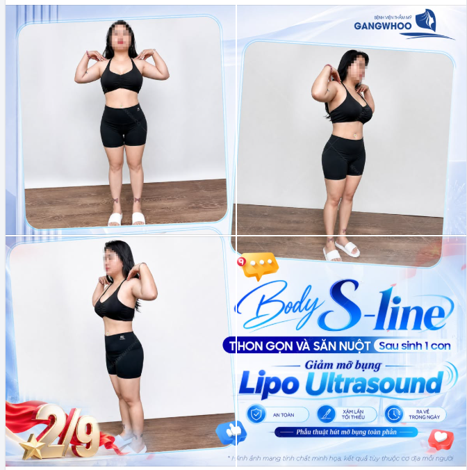BODY S-LINE THON GỌN VÀ SĂN NUỘT