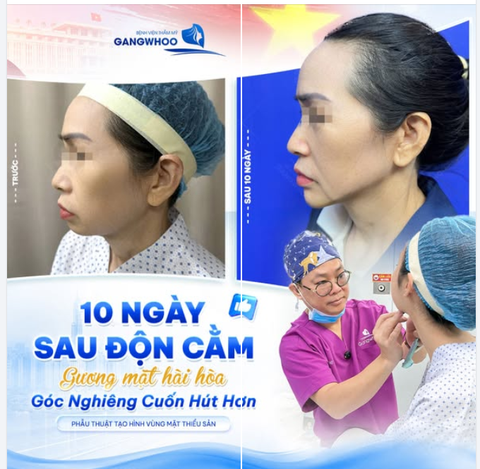 10 NGÀY SAU ĐỘN CẰM TẠI GANGWHOO