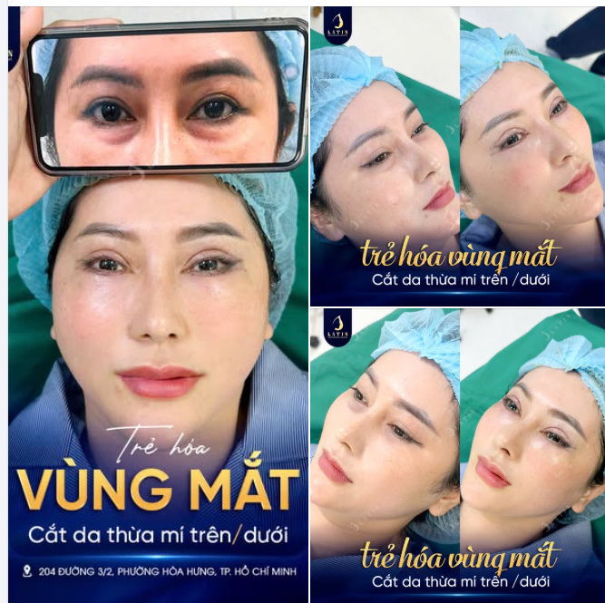 TẠM BIỆT ĐÔI MẮT MỆT MỎI – "TRẺ HÓA" THẦN THÁI CHỈ VỚI MỘT THAY ĐỔI NHỎ