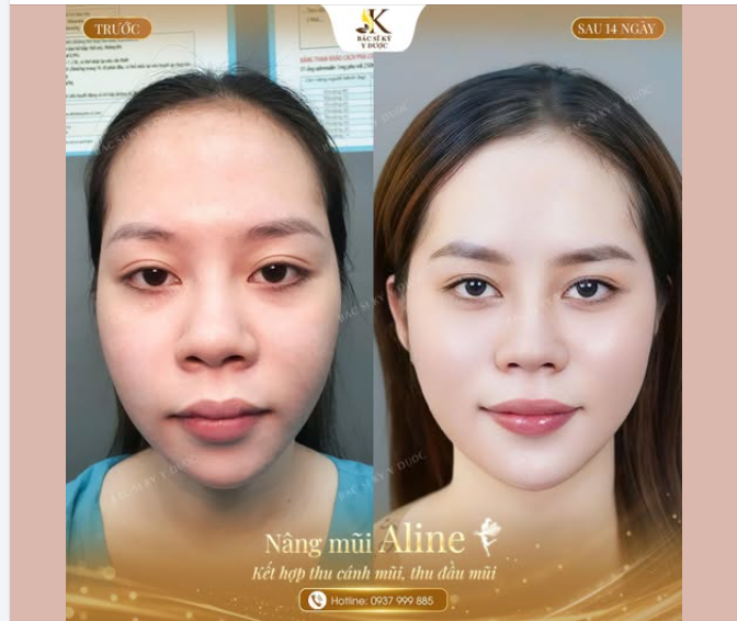 Chiếc mũi “hack” visual: cao hơn, mặt nhìn thon hơn!