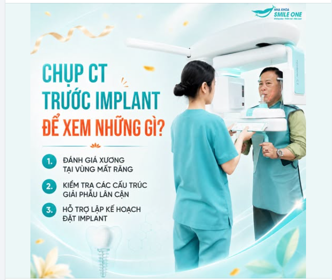 CHỤP CT TRƯỚC KHI CẤY IMPLANT ĐỂ XEM NHỮNG GÌ?