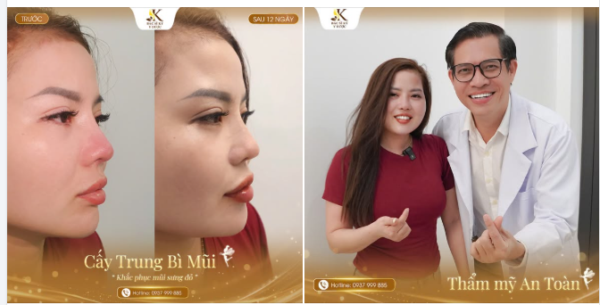 THAY ĐỔI MỘT CHÚT – NHƯNG ĐỦ ĐỂ GƯƠNG MẶT BỪNG SÁNG
