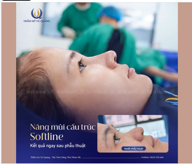 BIẾN HÌNH MŨI CÀ CHUẠ, LỖ MŨI BẸT THÀNH DÁNG MŨI TỰ NHIÊN, THANH THOÁT