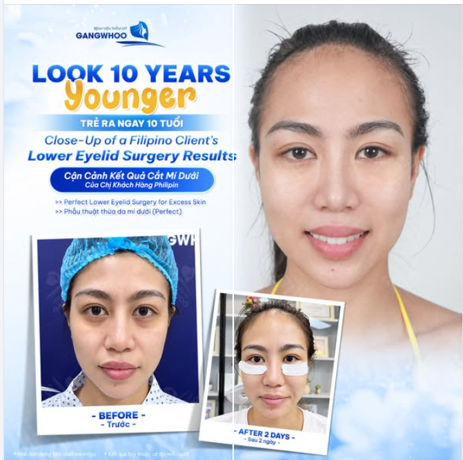 Một đôi mắt tươi tắn không chỉ giúp gương mặt trông trẻ trung hơn mà còn mang đến thần thái rạng rỡ, linh hoạt hơn.