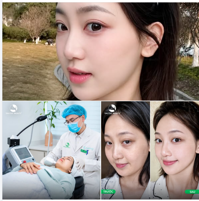 ĐÓN LỄ 2/9 RẠNG RỠ: TRẺ HÓA ĐA TẦNG - NÂNG CƠ SIẾT GỌN CÙNG HIFU Q+